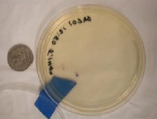 Petri dish with a single E. coli colony on Easygel medium